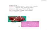 肝臓の疾患 - 東京大学 · 肝細胞壊死：細胞レベル、小葉区分、重篤度 循環障害：ニクズク肝、門脈低形成（血管異形成） 炎症性疾患：真菌・細菌性、ウイルス性、寄生虫性