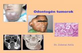 Odontogén tumorok - SotePedia...Odontogen epithelium érett, fibrosus stromával, odontogen ectomesenchyma nélkül b./ Odontogen epithelium odontogen ectomesenchymával, kemény
