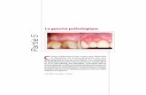 Partie 5 - Edimark · es gingivites induites par la plaque dentaire sont des maladies d’origine bactérienne. L’inflammation gingivale est dite induite par la plaque car les biofilms