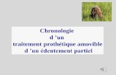 Chronologie d ’unletexierserge.com/2eme-cycle/pap-d1-chronologie-comment... · 2018-03-29 · Réalisation d ’un modèle maxillaire et mandibulaire de diagnostic 1-Observation