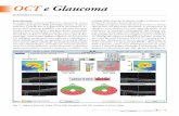 OCT e Glaucoma - Portale OCulistica Amedeo Lucente · Nella versione del software 6.0 dei Cirrus è possibile ese-guire scansioni sulle cellule ganglionari in macula con “Ganglion