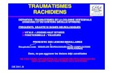 Traumas rachidiens IFSI1 - IFSI DIJON€¦ · traumatismes rachidiens definition : traumatismes de la colonne vertebrale (osseuse ... pronostic des lesions medullaires récupération