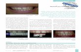 á«æ°ùdG ÚH äÉZGôØdG ¥ÓZEG âjRƒÑªμdÉHarabdental.com/arab_2012_03_s0016.pdf · negative aspects of the presentation of the teeth. Positive aspects are e.g. natural