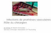 Service Chirurgie Vasculaire Ch Tourcoing · TVP Œdème des MI +++ *Benjamin et al: Arterial reconstruction with deep leg veins for treatment of mycotics aneurysms.J Vasc Surg 1999;