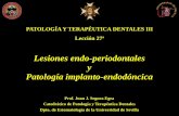 PATOLOGÍA Y TERAPÉUTICA DENTALES III Lección …...2) Absceso periodontal (dento-alveolar). 3) Imagen radiolúcida de pérdida ósea alveolar, cuya etiología (pulpar, periodontal