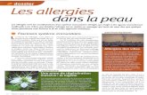 s577827dbc61d3bd6.jimcontent.coms577827dbc61d3bd6.jimcontent.com/.../name/les_allergies_dans_la_peau.pdfLes allergies dans la peau Les allergies sont les manifestations d'un système