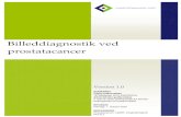Billeddiagnostik ved prostatacancer · Anbefaling 3 udgør ligesom 5 og 8 et dansk konsensusbaseret forbehold i forhold til EAU Prostate Cancer Guidelines, hvor de målrettede biopsier