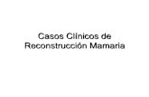 Caso Clínico de Reconstrucción Mamaria · 2017. 5. 22. · Casos Clínicos de Reconstrucción Mamaria Fernando Hernanz de la Fuente . Expansión-Prótesis . Diseño de colocación