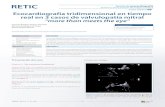 C Ecocardiografía tridimensional en tiempo real en 3 casos ...video.grupocto.com/videosEspecialidades/Revista... · loplastia mitral (AM) por estenosis aórtica e insuficiencia mitral
