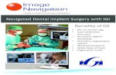 Navigated Dental Implant Surgery with IGI Benefits of IGI · 2018. 12. 18. · Using IGI, the dental surgeon views both the current position of the drill and the plan superimposed