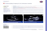 Multimodality imaging of cor triatriatum sinister croatica 2019 14_3... · 2019. 4. 27. · Introduction: Cor triatriatum sinister (CTS) is a very rare congenital cardiac malformation