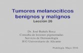Tumores melanocíticos benignos y malignosumh2028.edu.umh.es/wp-content/.../2016/07/tema-26-Tumores...y-m… · Tumores melanocíticos benignos y malignos. Desarrollo:-Lesiones melanocíticas