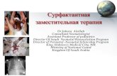 Сурфактантная заместительная терапияpedneo-kazan.ru/netcat_files/userfiles/Surfactant Replacemnt therap… · РДС. Respiratory failure secondary