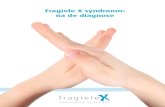 Fragiele X syndroom: na de diagnose · 2016. 11. 11. · 10 fragiele X syndroom: na de diagnose 11 2 Ontwikkeling van jongens en meisjes Het is niet te voorspellen hoe de ontwikkeling