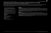 Lipoma intramuscular no músculo subescapular · Sao Paulo Med J. 2014; 132(1):65-7 65 DOI: 55657 CASE REPORT Intramuscular lipoma of the subscapularis muscle Lipoma intramuscular