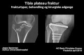 Tibia plateau fraktur - AO Danmarkao-danmark.dk/wp-content/uploads/2020/02/AO_Basic2019-Ti... · 2020. 2. 3. · Tibia plateau fraktur Frakturtyper, behandling og kirurgiske adgange