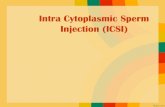 Intra Cytoplasmic Sperm Injection (ICSI)vlm.ub.ac.id/pluginfile.php/44418/mod_resource/content/1... · 2020. 4. 8. · •Dapat menentukan jenis kelamin anak yang kita inginkan Kerugian: