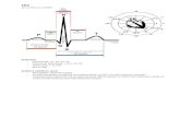 EKG - Honeyacid · EKG:ssa PR-intervalli pitenee jatkuvasti kunnes yhtäkkiä näkyy P-aalto jota ei seuraa QRS-kompleksi. Tämä sekvenssi toistaa itseään. ... LP HB Akselideviaatio