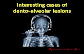 Interesting cases of dento-alveolar lesionsweb1.dent.cmu.ac.th/mis/dentelearning/uploads/material/...ข อ 6 1. Soft tissue of nose 2. - 2-unit bride from 11 –21. - Tooth 11 RCT