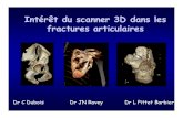 Intérêt du scanner 3D dans les fractures articulaires · atteinte du fond du cotyle ? Vue per-opératoire : planification du geste chirurgical Fracture de la tête de la fibula
