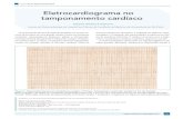Eletrocardiograma no tamponamento cardíaco · exibia grandes alterações. Verificava-se taquicardia sinusal e IProfessor livre-docente pela Faculdade de Medicina da Universidade