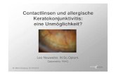 Contactlinsen und allergische Keratokonjunktivitis: eine ......Steriles Ulcus, „culture negative“ Potentielle Allergene im Zusammenhang mit dem Tragen von CL Bakterientoxine 62.