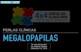 PERLAS CLÍNICAS MEGALOPAPILAS · 2020. 7. 22. · PERLAS CLÍNICAS Dr. Juan Sampaolesi Dr. Mauricio Aguirre Glaucoma 4 x4 2016. EL GRAN IMITADOR. ADVANCED GLAUCOMA MEGALOPAPILAS.