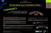 Prothèse sur implant ANA. Prothèse sur implant Polissage ......Prothèse sur implant ANA.®. Les restaurations transvissées hybrides sont un choix de qualité en remplacement des