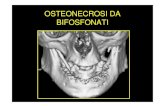 OSTEONECROSI DA BIFOSFONATI · 2016. 12. 14. · anni (emivita 10-12aa) • Basso assorbimento intestinale ... (60%), rispetto alla mascella (25%) • Più raro il coinvolgimento