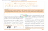 Computed tomography imaging of complications of acute ...