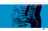 W 15 Spinalna Stenoza - Ortopedska klinika