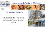 Estenose Aórtica Valvar Dr. Walter Rabelo