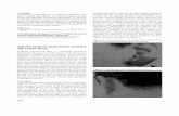Auricular pyoderma gangrenosum associated with Crohn’s …