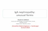 IgA nephropathy: unusual forms