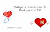 Malignus ritmuszavarok, Perioperatív PM