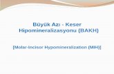 Büyük Azı - Keser Hipomineralizasyonu (BAKH)