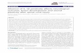 PDF - Journal of Neuroinflammation