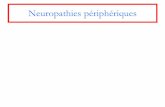 Neuropathies périphériques