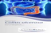 Colitis ulcerosa - Gastro-Liga