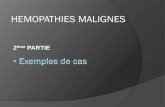 HEMOPATHIES MALIGNES - labmed