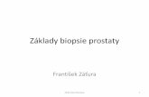 Základy biopsie prostaty