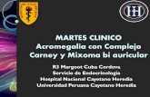 MARTES CLINICO Acromegalia con Complejo Carney y Mixoma bi ...