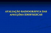 AVALIAÇÃO RADIOGRÁFICA DAS AFECÇÕES ESOFÁGICAS