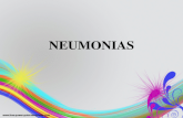 Neumonias pedia 2
